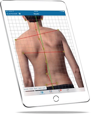 Quiropráctico Palma de Mallorca Análisis Postural