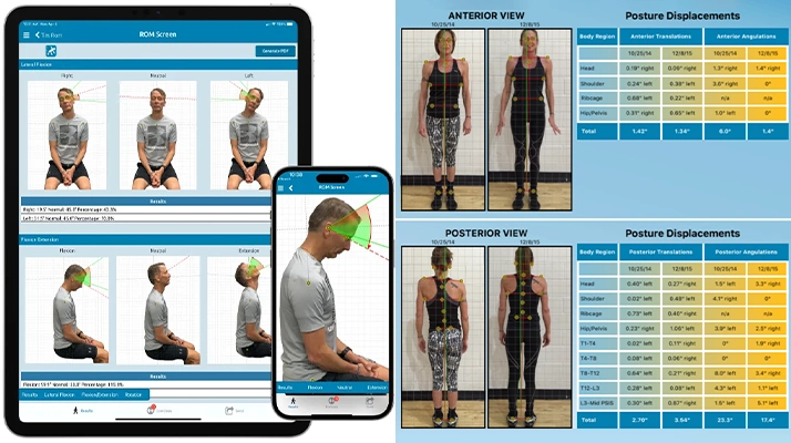 Quiropráctico Palma de Mallorca Análisis Postural